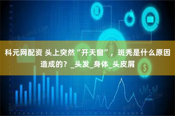 科元网配资 头上突然“开天窗”，斑秃是什么原因造成的？_头发_身体_头皮屑